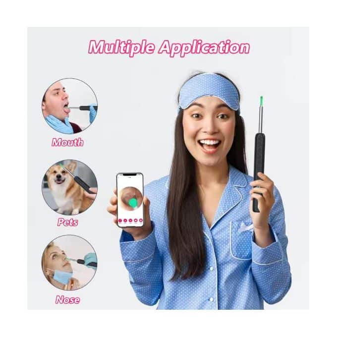 Ear Wax Removal with Ear Spoons, 1080P HD Camera, Bluetooth & WiFi – Smart Ear Wax Remover- Visual Ear Cleaner Otoscope for iPhone & Android