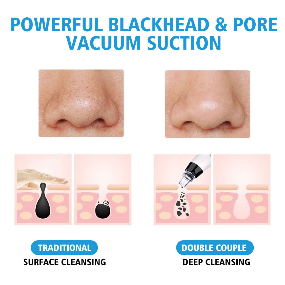 Multifunctional Electric Pore Cleaner & Blackhead Remover Vacuum