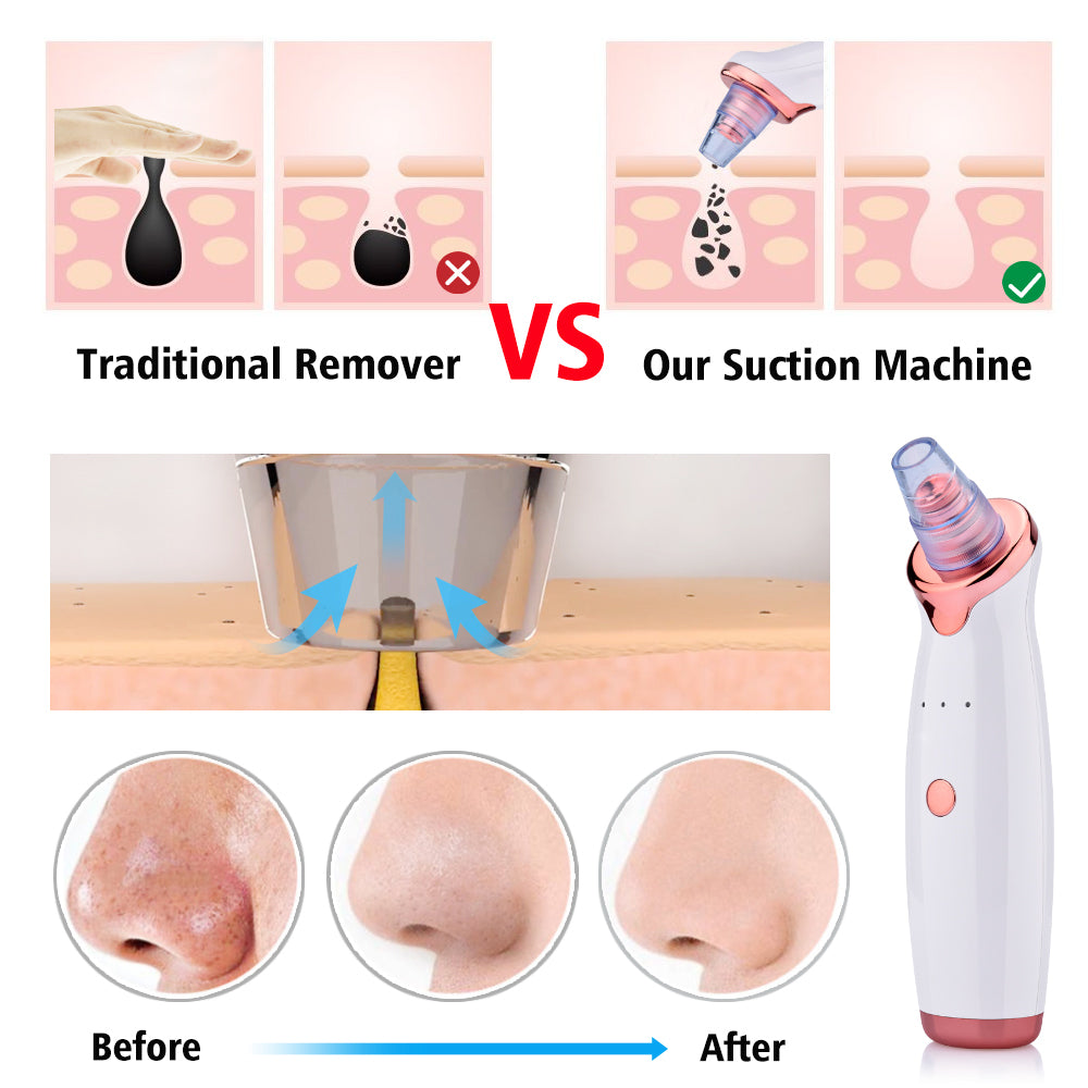 Multifunctional Electric Pore Cleaner & Blackhead Remover Vacuum