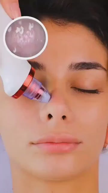 Multifunctional Electric Pore Cleaner & Blackhead Remover Vacuum